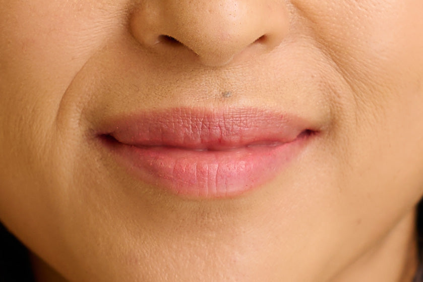Lips